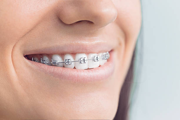 Best Wisdom Tooth Removal  in Miami Lakes, FL